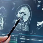 curso-residentes-neurocirugia-iavante-2026-tercera edicion-