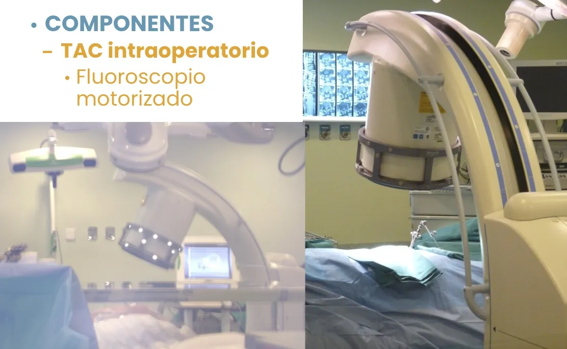 Figura 22.- Componentes del neuronavegador 3D: TAC intraoperatorio y fluoroscopio motorizado.