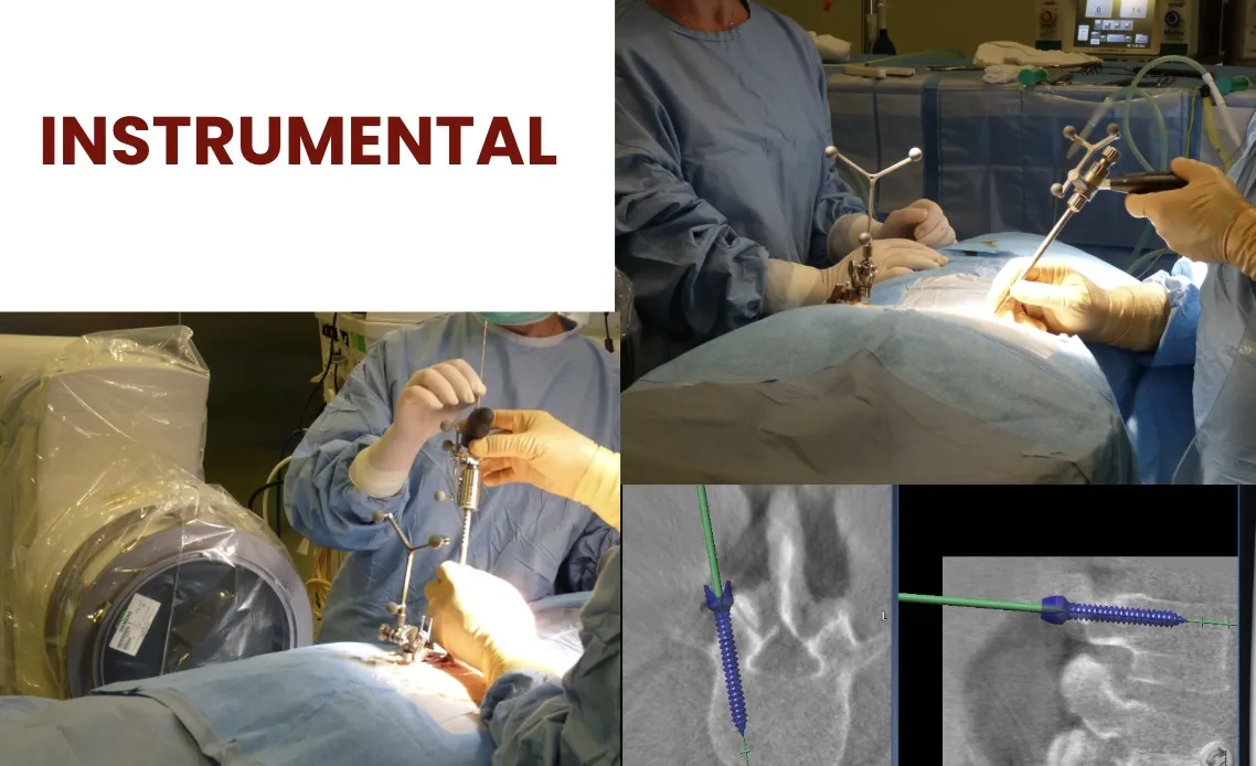 Figura 23.- Instrumental específico para uso con neuronavegador.