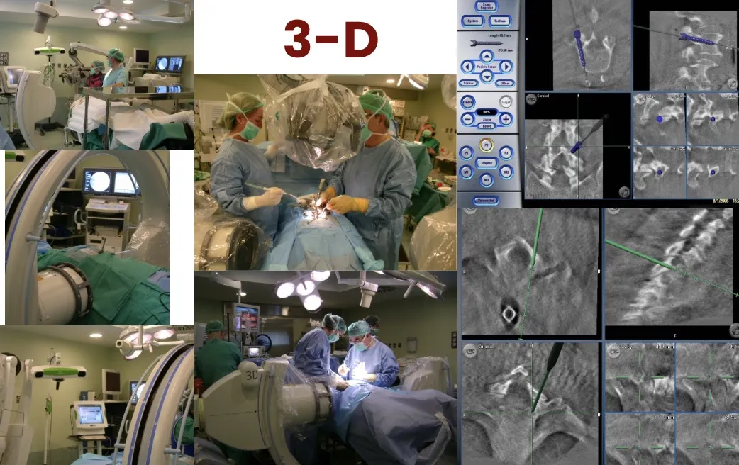 Figura 24.- Visualización tridimensional con neuronavegador.