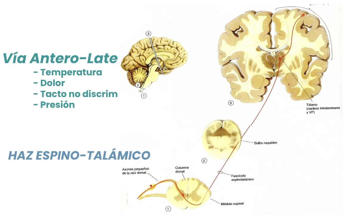 Figura 5.- Vía antero-lateral: haz espino-talámico, encargado de la sensibilidad al dolor y temperatura.