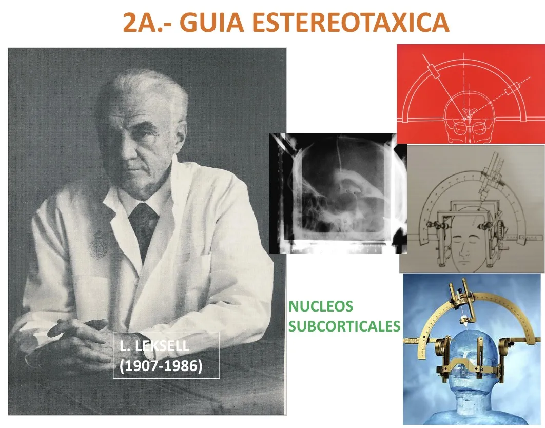 Figura 10.- Guía estereotáxica de L. Leksell (1907-1986), empleada para la localización de núcleos subcorticales profundos