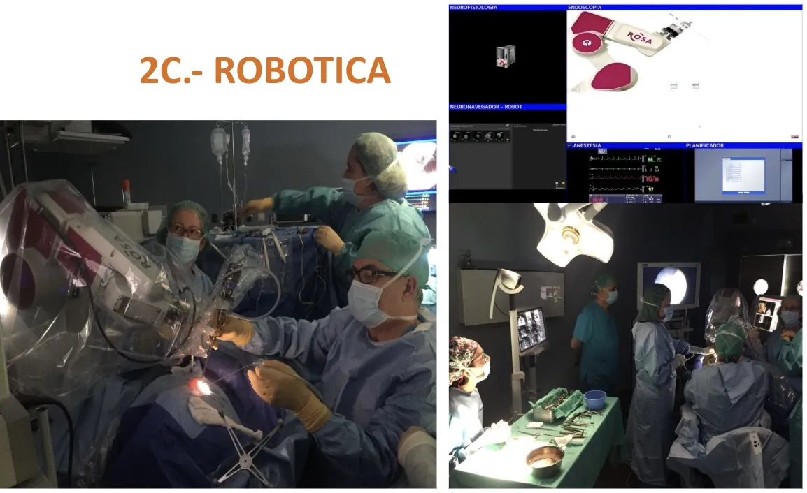 Figura 14.- Sistema robótico aplicado a la neurocirugía estereotáctica