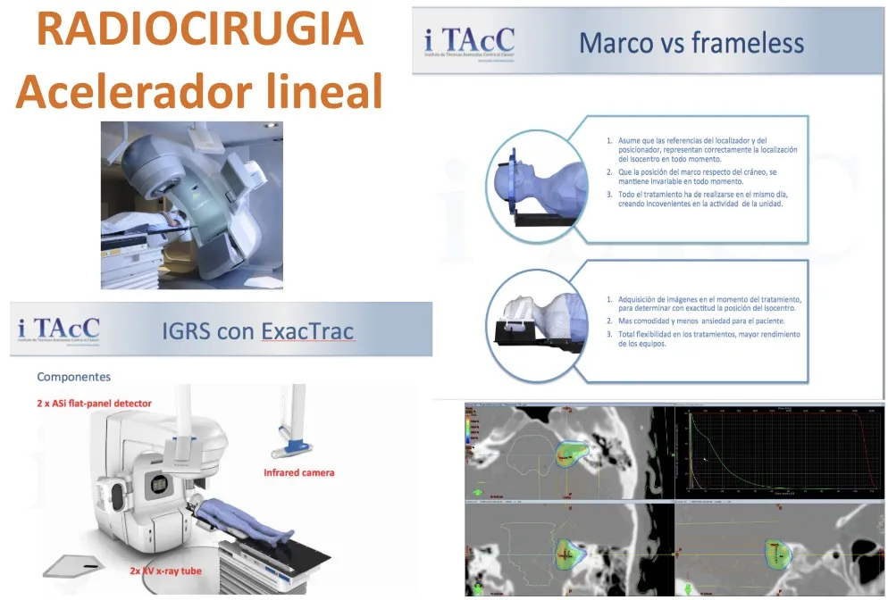 Figura 16.- Sistema de radiocirugía mediante acelerador lineal, sin necesidad de marco estereotáctico
