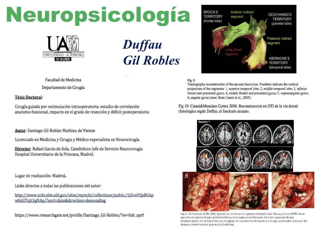 Figura 20.- Exploración neuropsicológica intraoperatoria, con referencia al trabajo de los doctores Duffau y Gil Robles