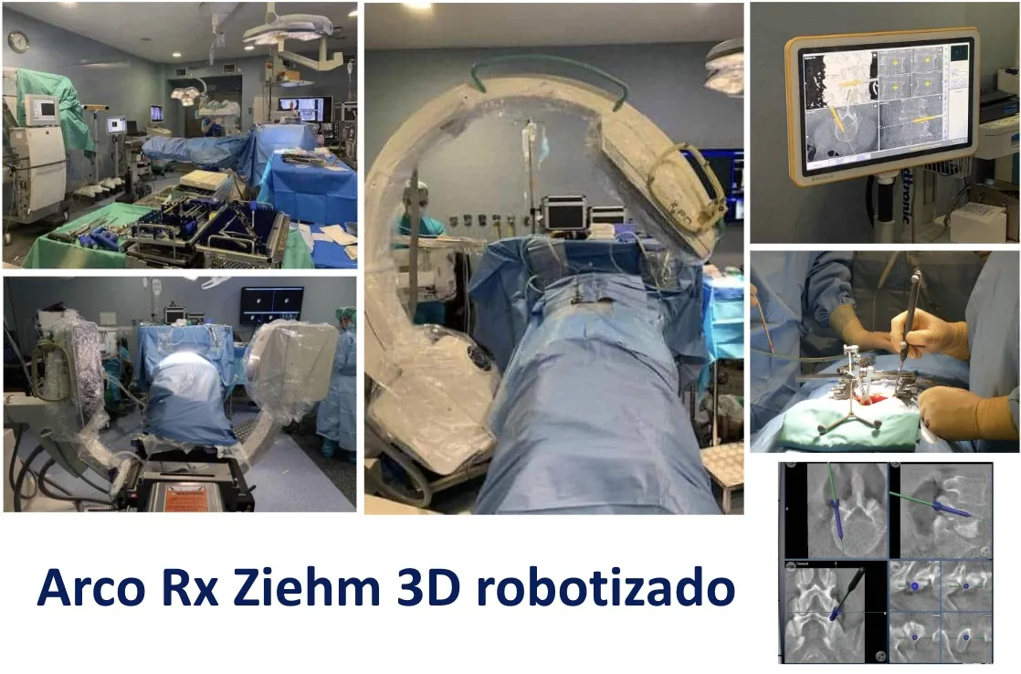 Figura 22.- Arco de rayos X Ziehm 3D robotizado, empleado en el neuronavegador de cirugía de columna
