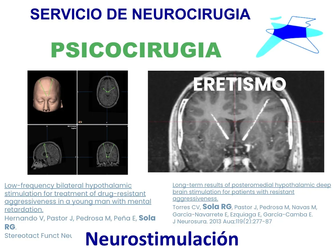 Figura 5.- Referencias de las publicaciones científicas sobre neuroestimulación en psicocirugía realizadas por el Servicio de Neurocirugía