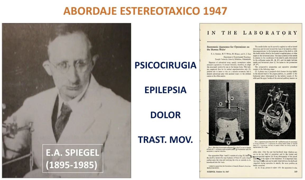 Figura 9.- El doctor E. A. Spiegel (1895-1985) y su abordaje estereotáxico de 1947, aplicado a la psicocirugía, la epilepsia, el dolor y los trastornos del movimiento